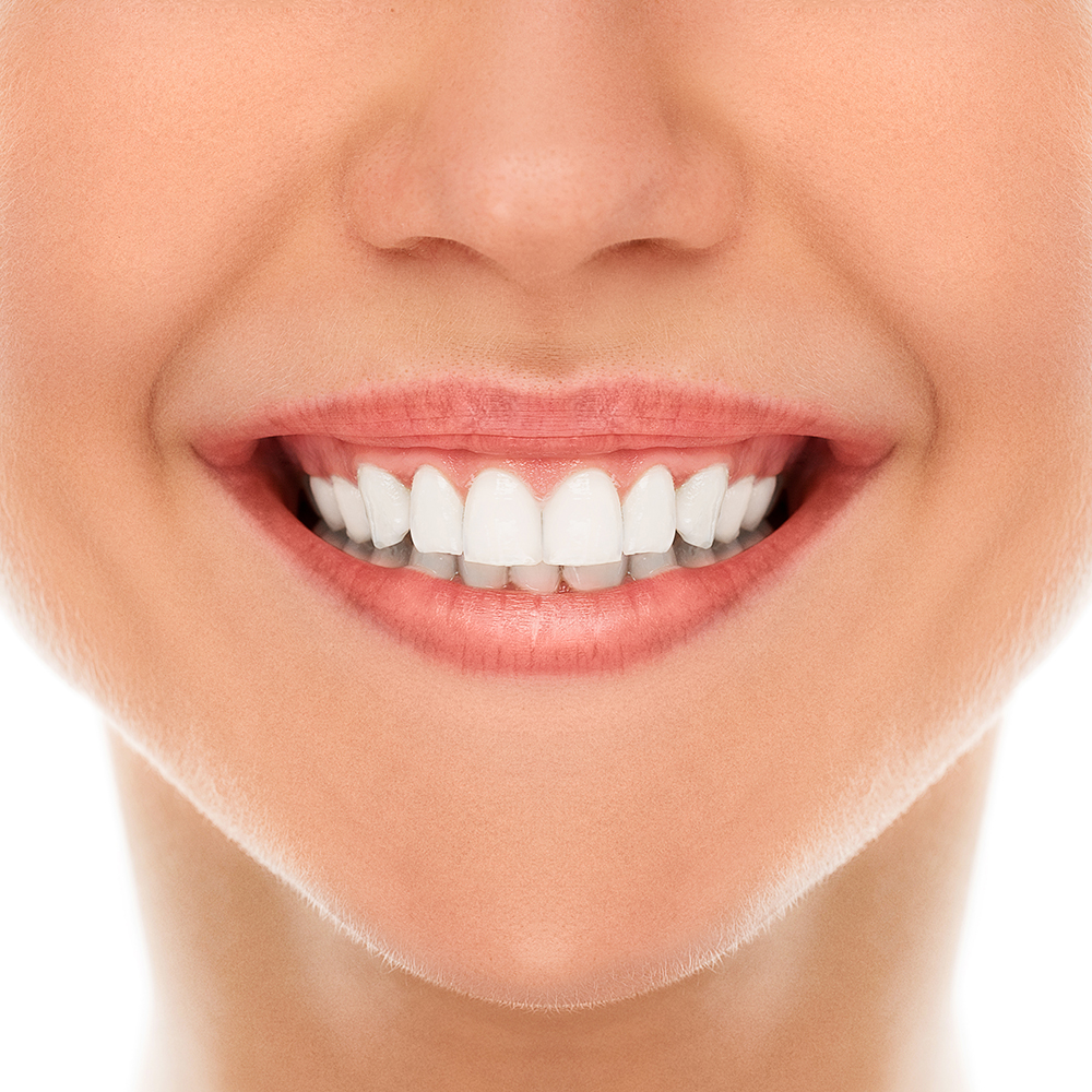 Co to jest bonding w stomatologii?