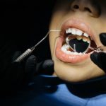 Sedacja wziewna w stomatologii