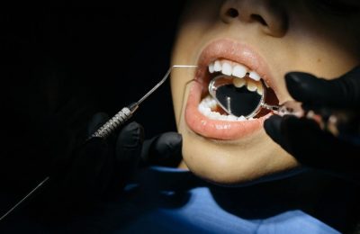 Sedacja wziewna w stomatologii