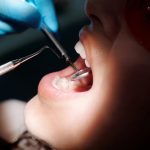 Zapalenie okostnej zęba objawy